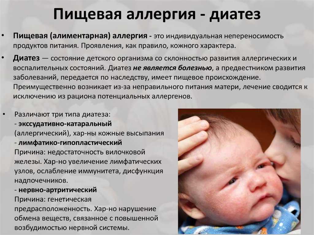 Аллергия У Новорожденного Диета Мамы