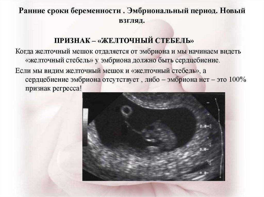 Замершая беременность | причины, последствия и лечение замершей беременности | компетентно о здоровье на ilive