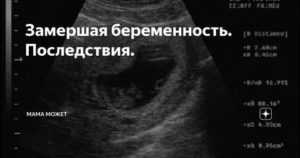 Жизнь после замершей беременности | компетентно о здоровье на ilive