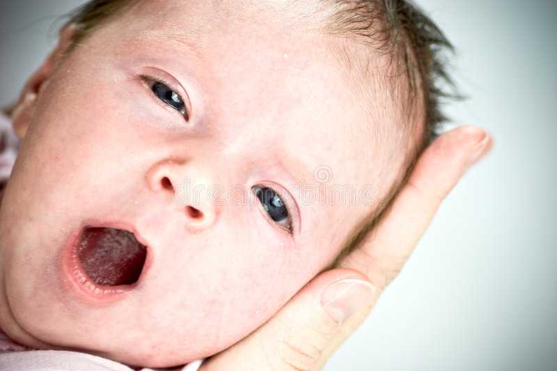 Увидев что новорожденный закатывает глаза родители волнуются: это нормальное явление или симптом заболевания Пройдет это со временем или необходимо лечение