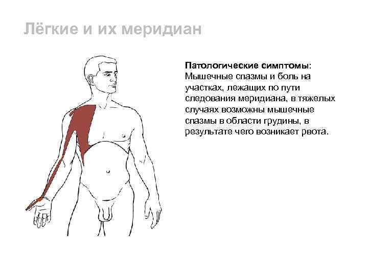 Мышечные спазмы по всему телу. Спазмы мышц грудной клетки. Болезненный мышечный спазм. Симптомы мышечного спазма.