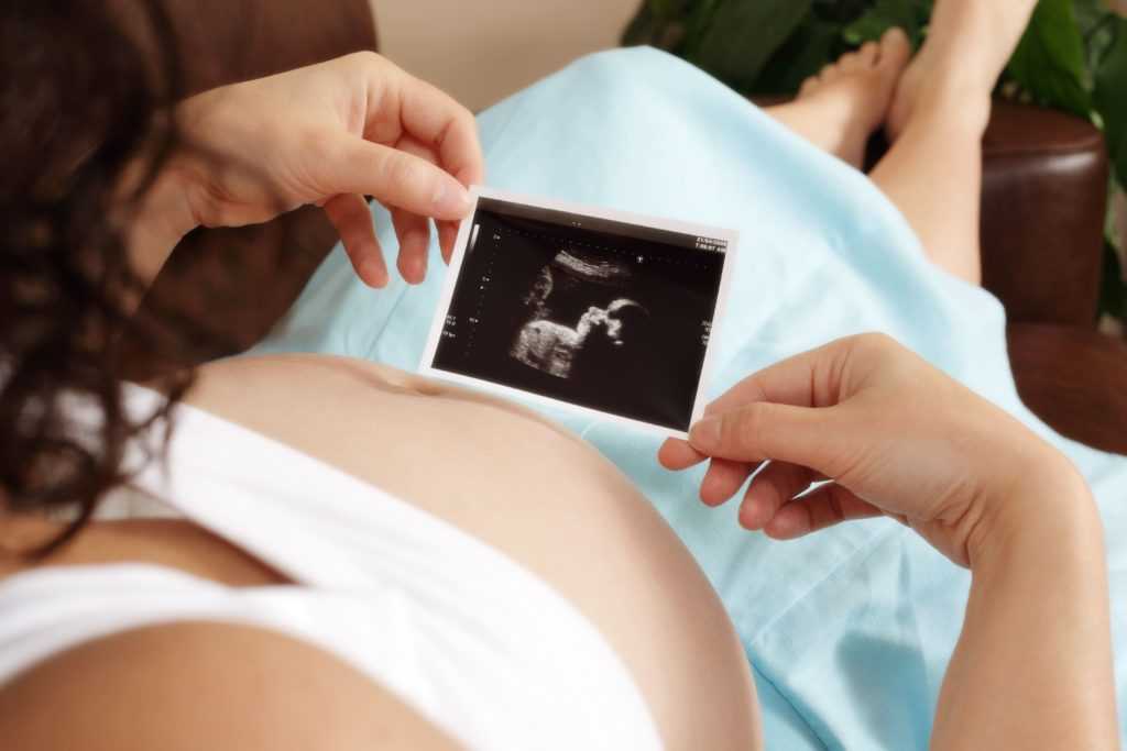 Можно ли делать флюорографию при беременности?