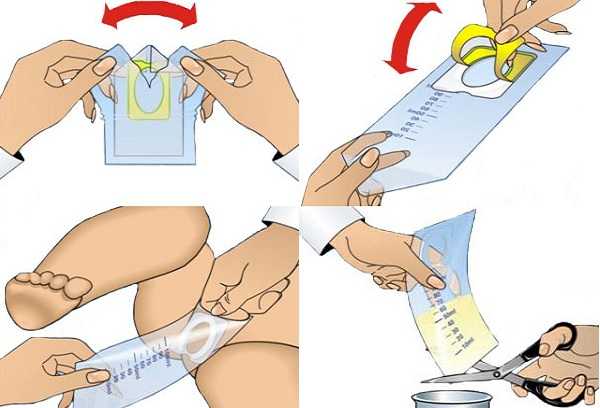Как заставить грудничка пописать для анализов