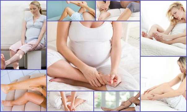 Почему при беременности на ранних и поздних сроках болят ноги, что делать?