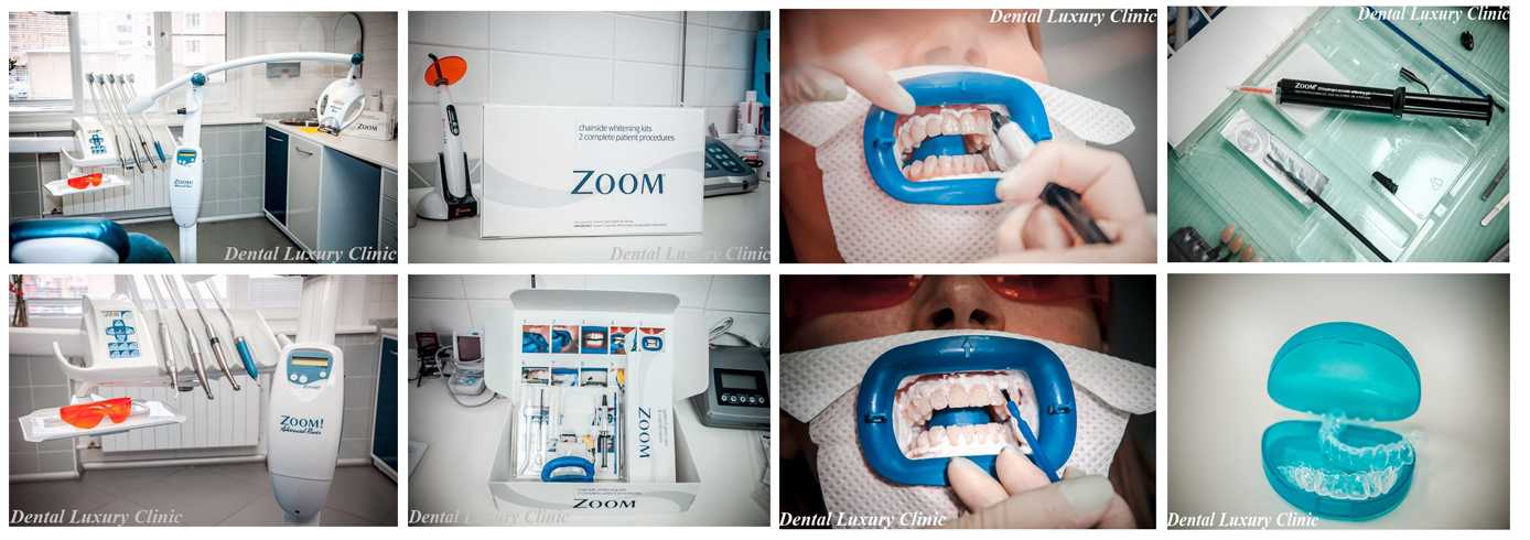 Стома отбеливание зубов zoom цена cs medica sonicmax cs 167 w