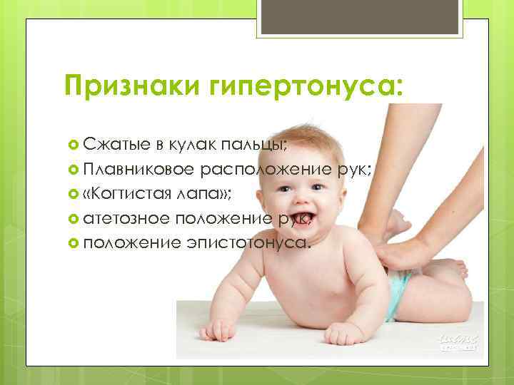 Мышечный тонус у детей: гипотонус, гипертонус, дистония / mama66.ru