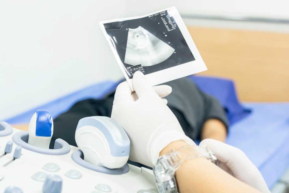 Внематочная беременность: причины, симптомы, диагностика и лечение в свао москвы