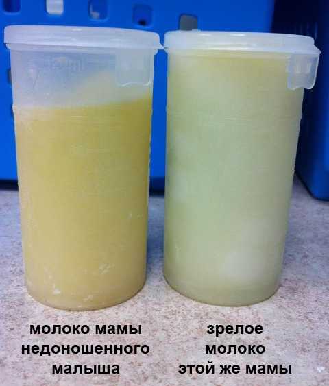 Как отличить молоко. Грудное молоко. Молозиво молоко цвет. Молоко желтого цвета. Переднее и заднее грудное молоко.