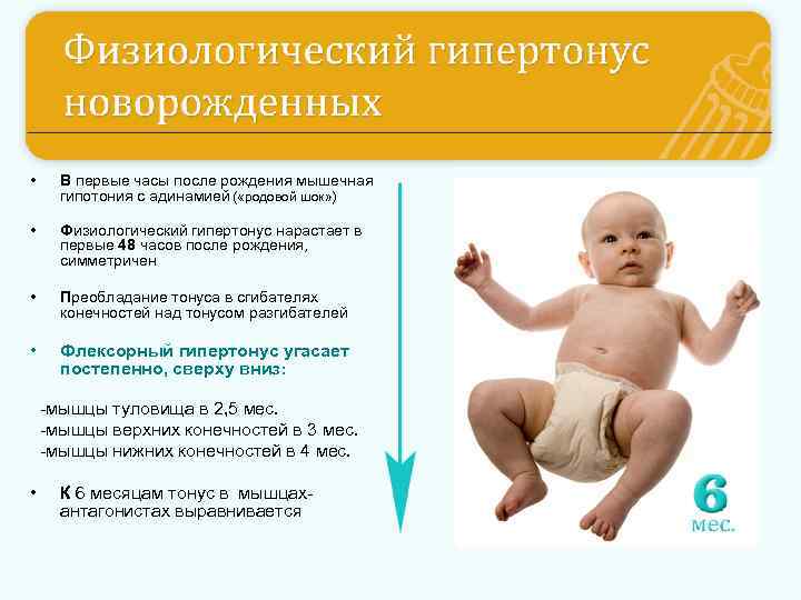 Гипертонус мышц у новорожденных и младенцев до года: симптомы и лечение у грудничков