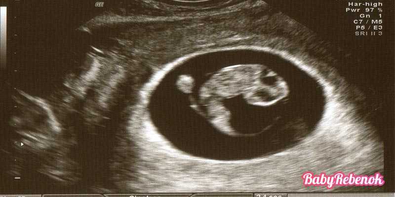 6 неделя беременности: что происходит с малышом и мамой, фото, развитие плода, ощущения