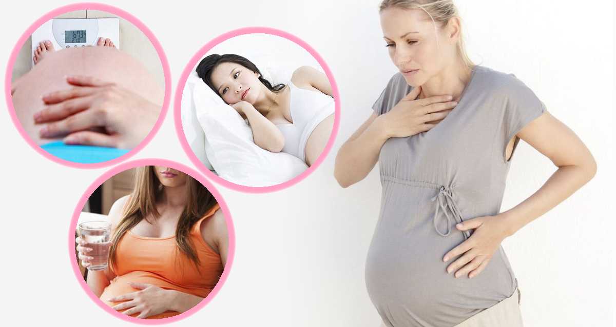 Очень сильная изжога у беременных — что делать?