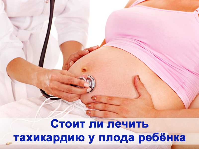 Тахикардия при беременности — причины, симптомы и лечение