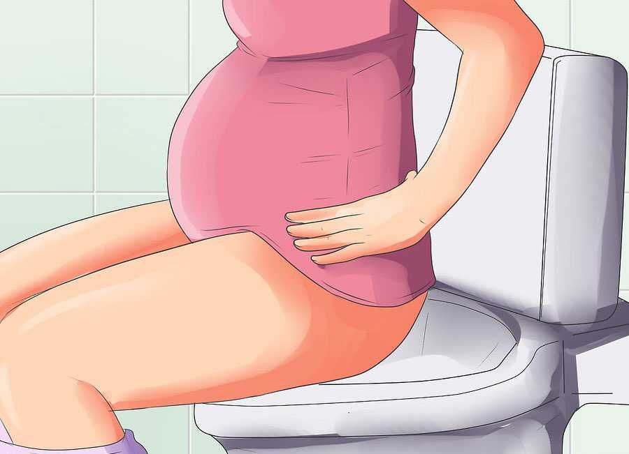 Наружный геморрой при беременности: 3 метода лечения и советы