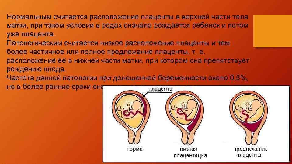 Низкая плацентация при беременности: что это такое, чем опасна, роды, что делать если плацента низко расположена / mama66.ru
