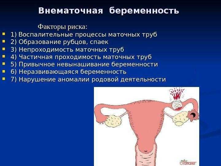 Внематочная беременность: операция, длительность, реабилитация и последствия :: syl.ru