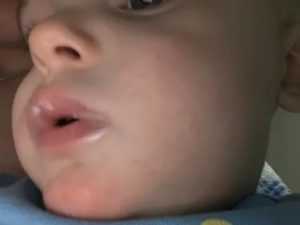 Слюни у новорожденного: почему 2 месячный ребенок пускает слюни пузырями