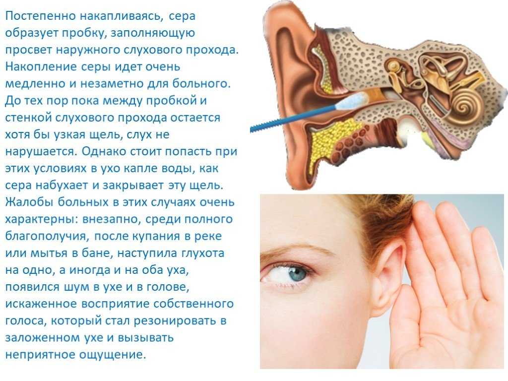 Почему закладывает уши при беременности и как с этим бороться pulmono.ru
почему закладывает уши при беременности и как с этим бороться