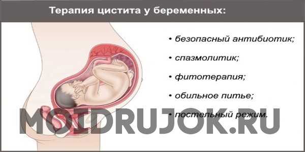 Цистит при беременности: признаки и лечение на ранних сроках, а также на 2 и 3 триместрах