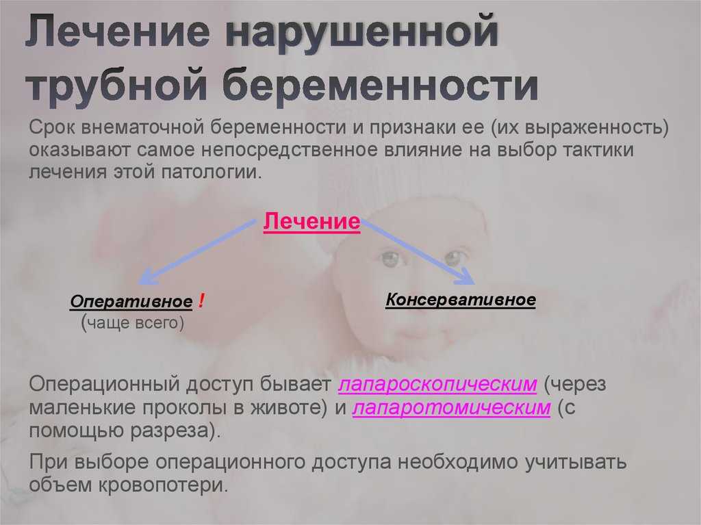 Внематочная беременность: признаки и симптомы, как определить на ранних сроках / mama66.ru
