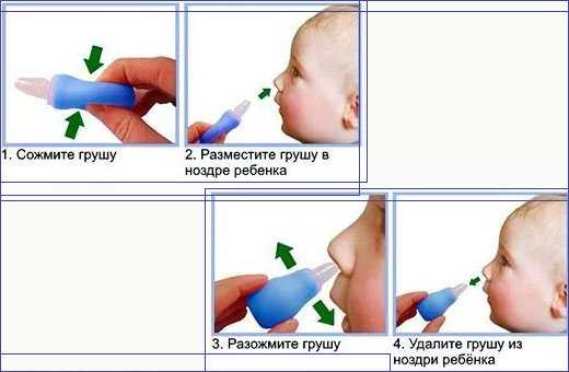 Как почистить нос новорожденному ребенку правильно от козявок и соплей
