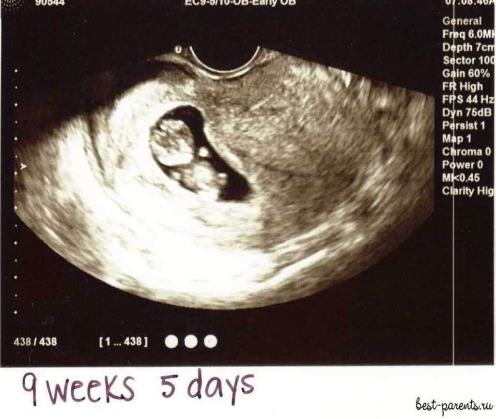 18 неделя беременности - что происходит с малышом и мамой