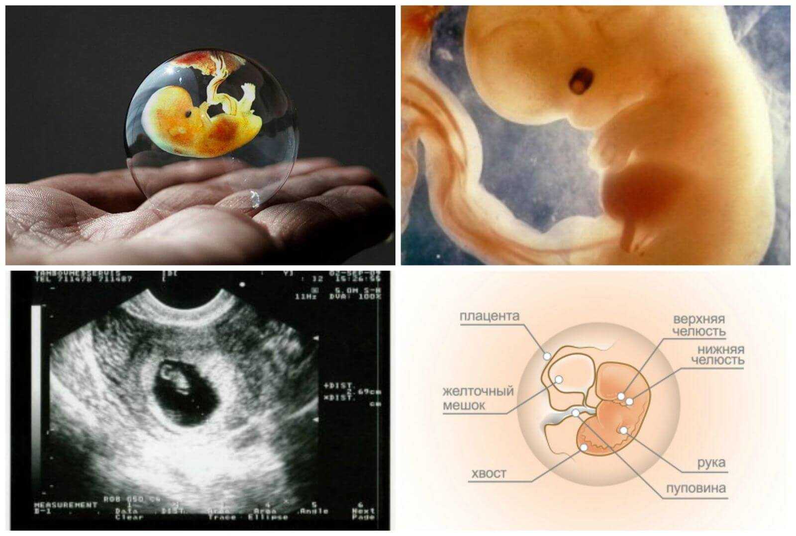 6 неделя беременности: что происходит в организме, новые ощущения, фото узи и видео