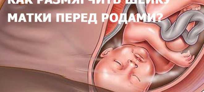 41 неделя беременности: перенашивание, программированные роды