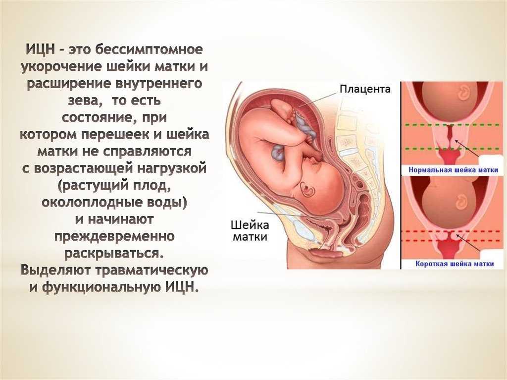Папаверин при беременности на ранних сроках | уроки для мам