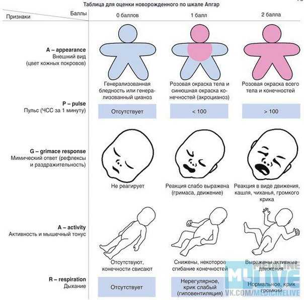Оценка общего состояния новорожденного по шкале апгар: таблица