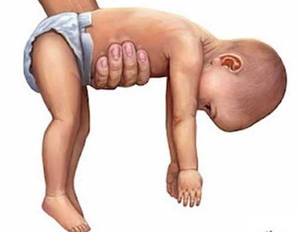 Тонус мышц ребенка и его нарушения   | материнство - беременность, роды, питание, воспитание