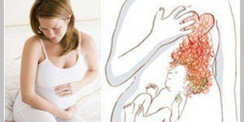 Симптомы и лечение рвоты желчью при беременности