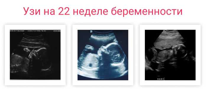 22 неделя беременности