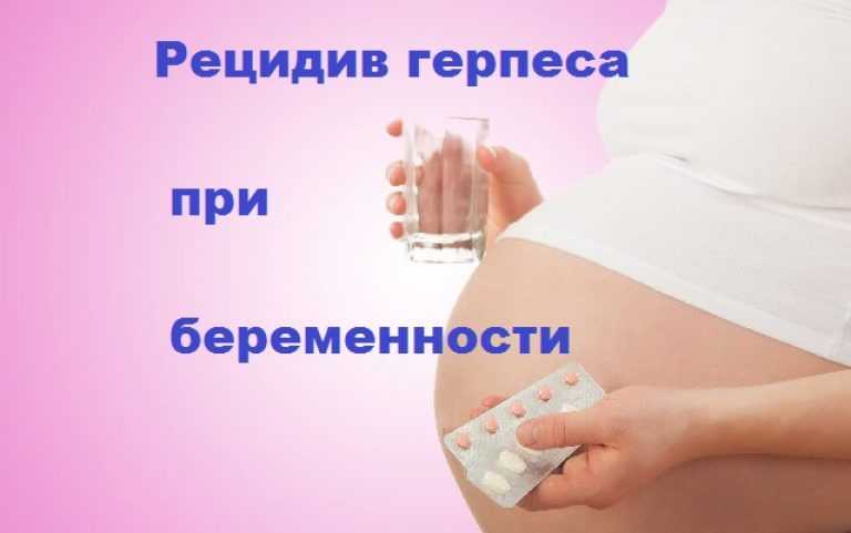 Герпес на губе и 2 триместр беременности: как не допустить роковых ошибок