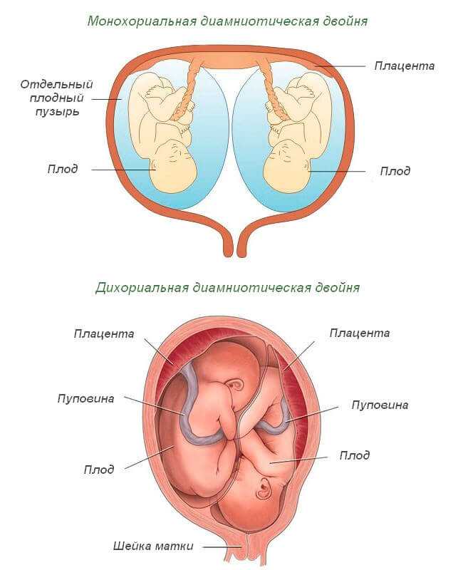 Низкая плацентация при беременности – что это значит? чем опасна низкая плацентация для ребенка и протекания беременности?