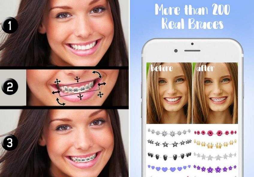 Железные брекеты. Брекеты реклама. Маска диляра. Лицевая дуга ортодонтия. Маска брекеты примерить.