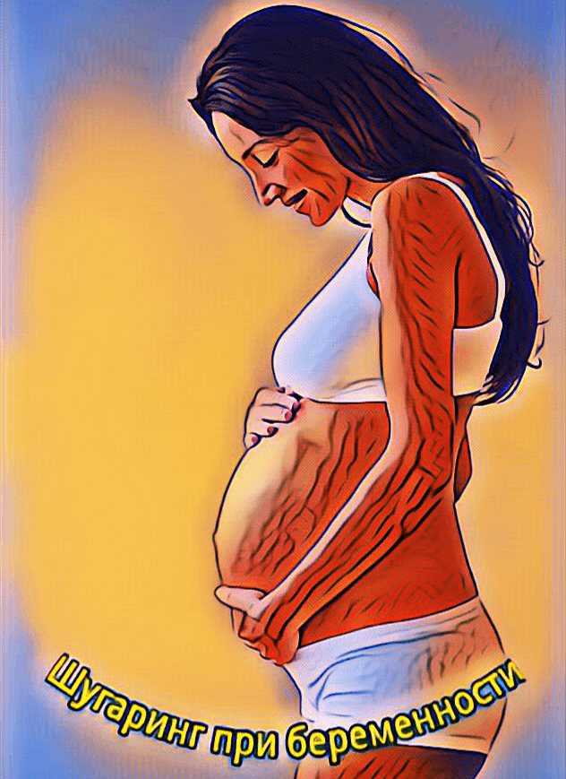 Шугаринг при беременности: технология эпиляции сахаром во время беременности