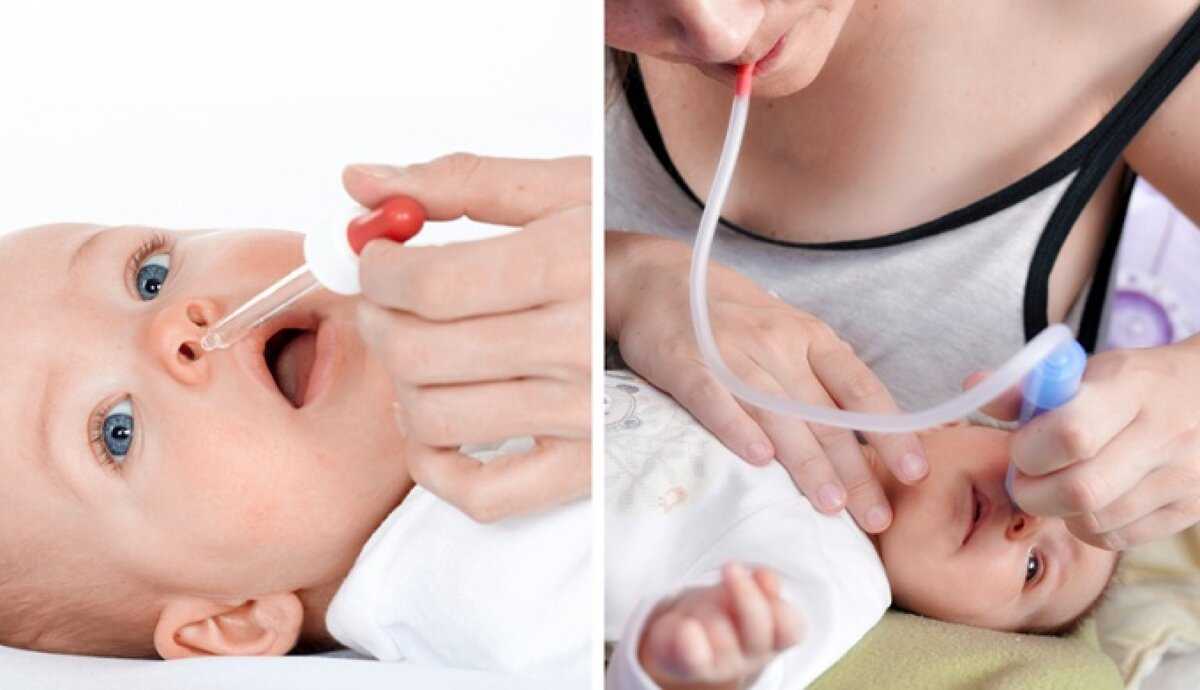 Как чистить нос новорожденному ребенку правильно: инструкция