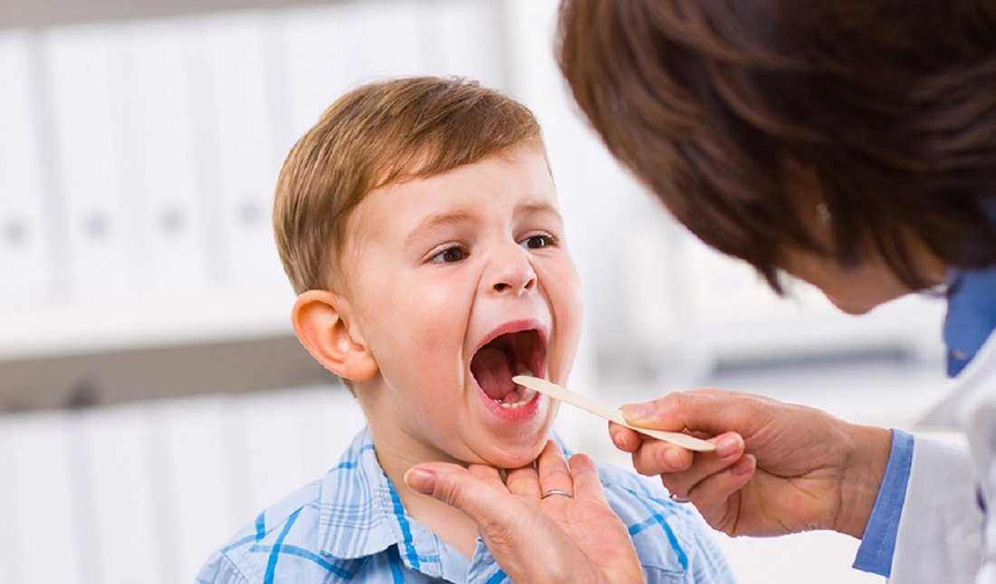 Хронический тонзиллит у ребенка, симптомы и лечение хронического тонзиллита у детей, профилактика обострений заболевания