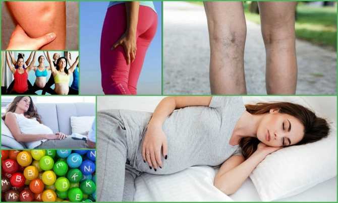 Болит нога правая при беременности | nogihelp.ru