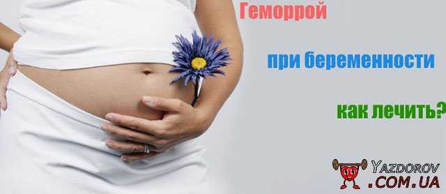 Геморрой при беременности - чем и как можно лечить?