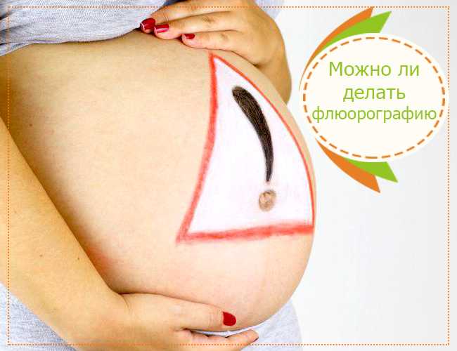Флюорография при беременности: как минимизировать облучение