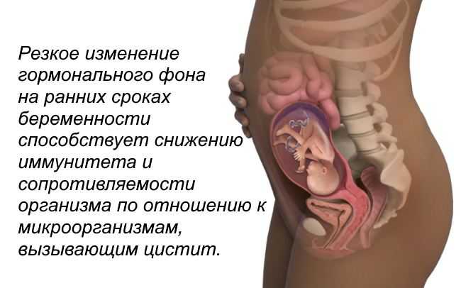 Беременность и цистит: признаки и лекарства от болезни / mama66.ru