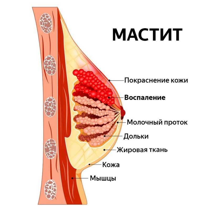 У блогерша Милены Иоанны новая грудь " Психоман