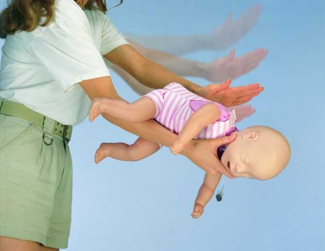 Спасение малыша: что делать, если ребенок подавился