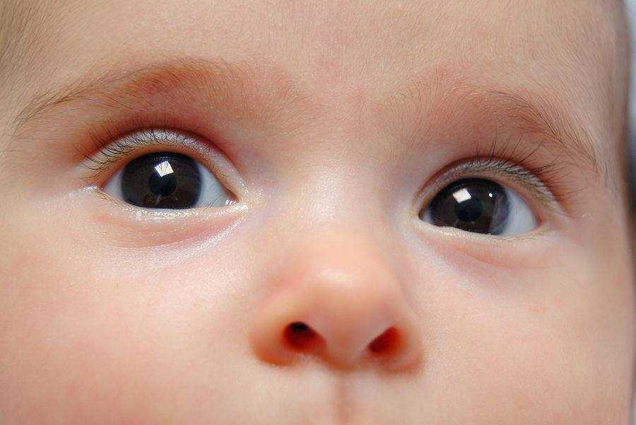 Когда меняется цвет глаз у новорожденных - "здоровое око"