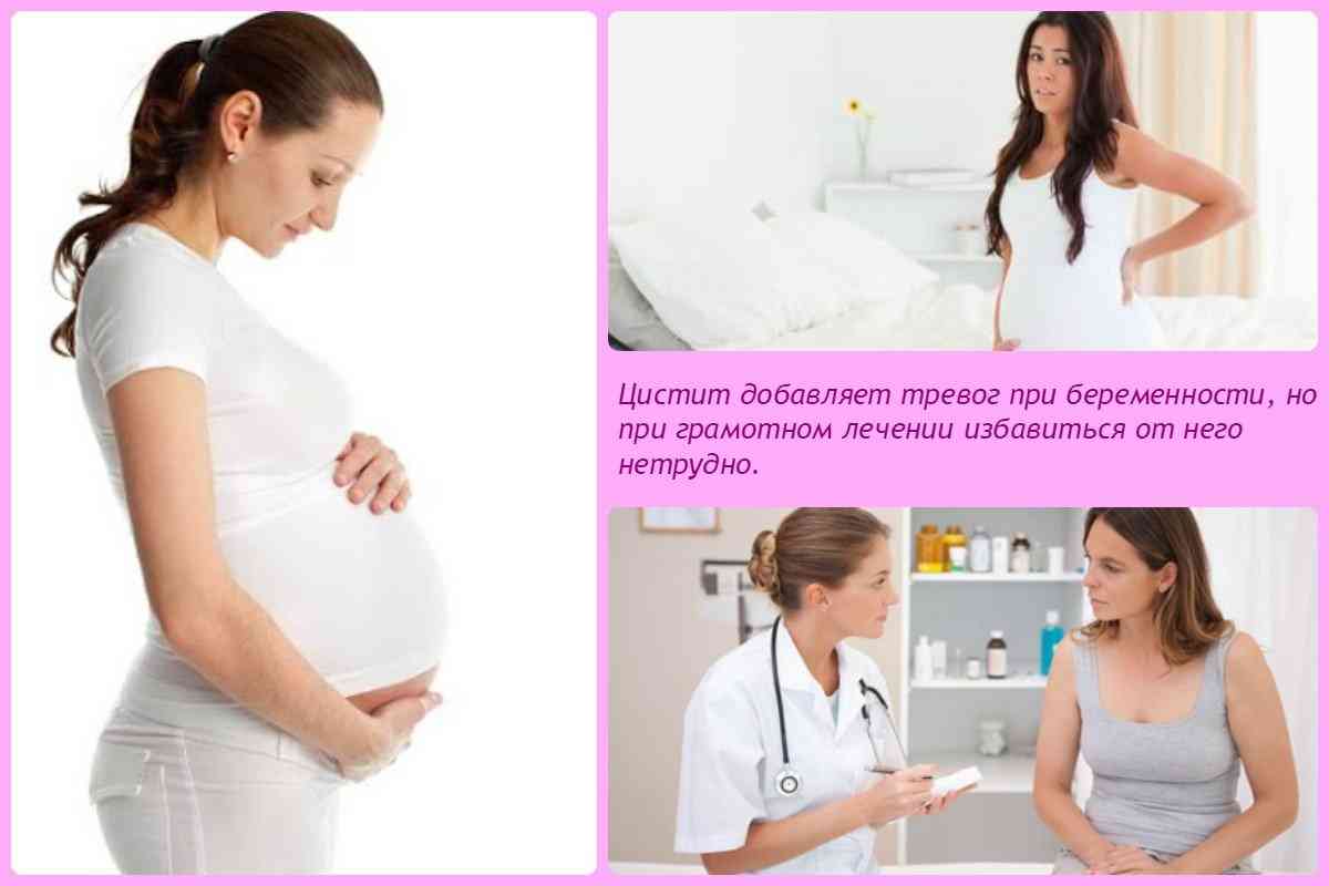 Как лечить цистит при беременности на ранних сроках?