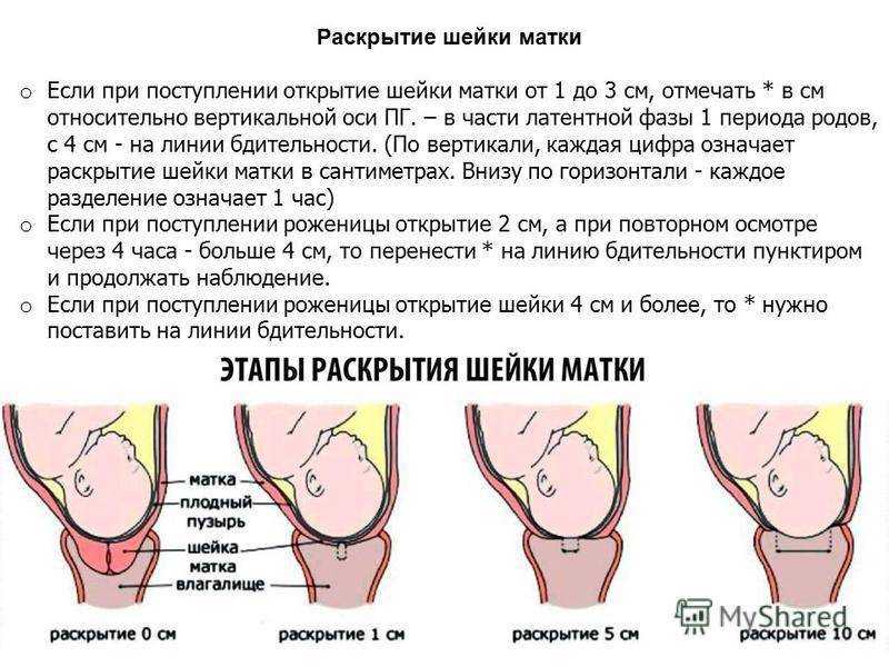 Как подготавливаться к родам: морально, психологически, физически? подготовка к родам: курсы :: syl.ru