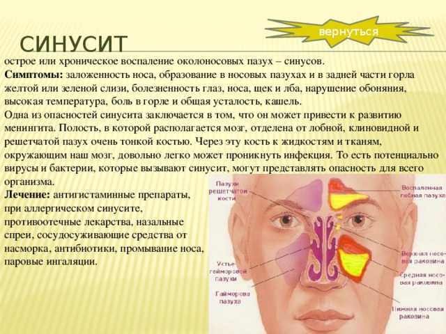 Острый и хронический гайморит при беременности: симптомы, лечения, последствия / mama66.ru