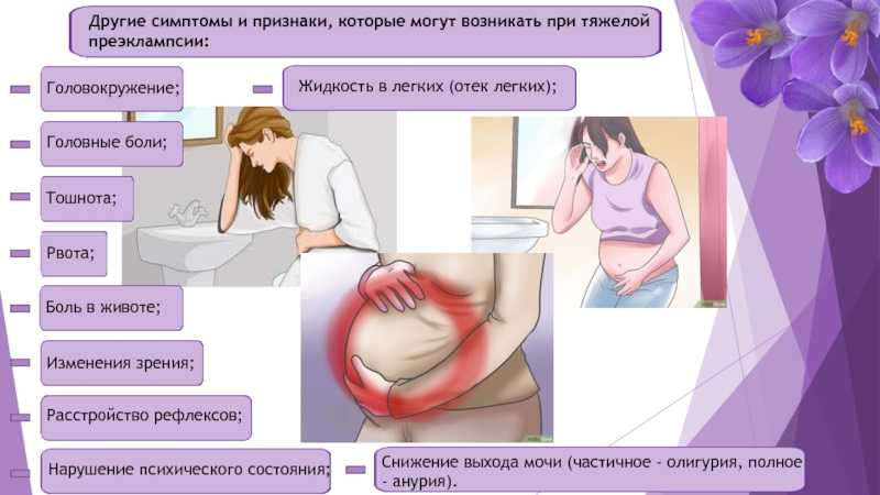 Когда начинает тошнить при беременности в норме / mama66.ru