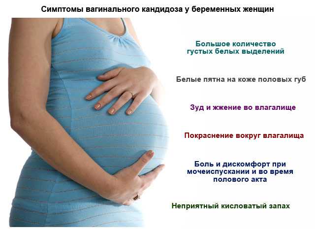Молочница при беременности: симптомы, опасность и лечение